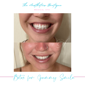 aesthetics boutique instagram post