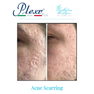 Copy of AB Before & After (1)