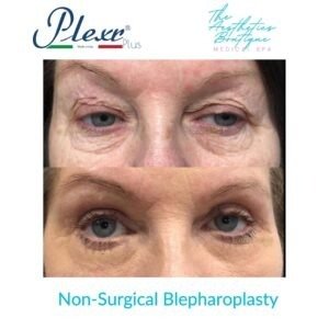 Copy of AB Before & After - 6