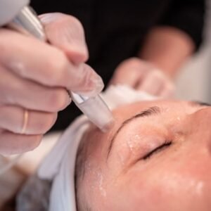 Holiday Promo: GLOW PEEL