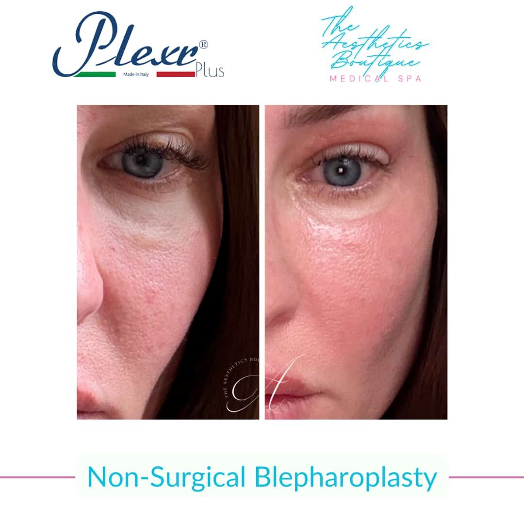 566450411_4159348970985286_3739138534310624143_n