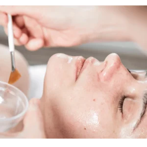 Chemical Peels in Hamilton and Binbrook | Peels for Pigmentation